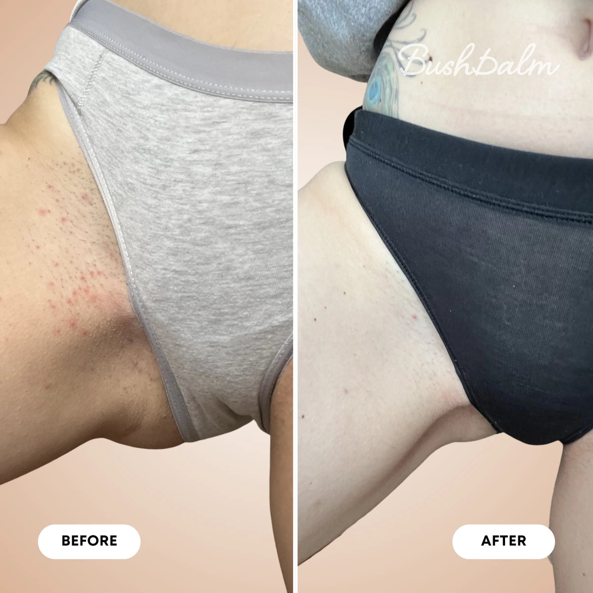 Sugar Cookie Ingrown Hair Exfoliating Scrub