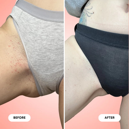 Summer Vacay Ingrown Hair Exfoliating Scrub