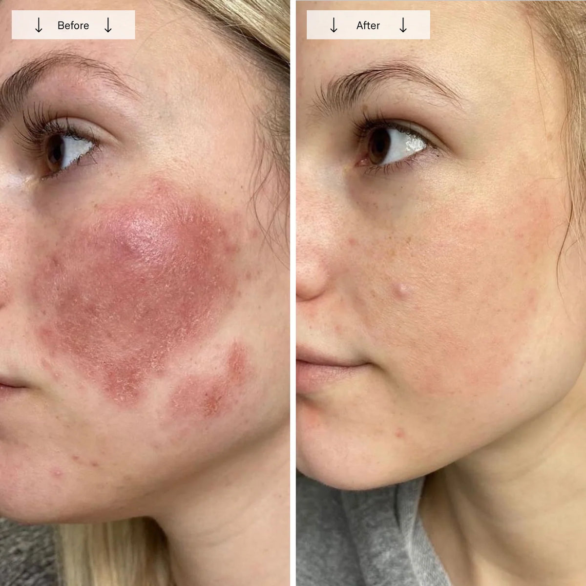 Omnilux Contour Face