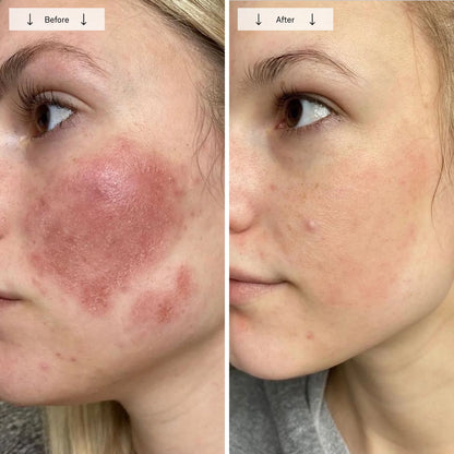 Omnilux Contour Face