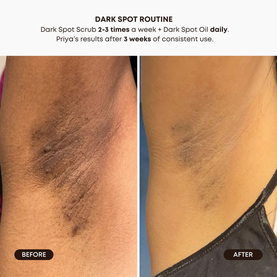 Lavender Lemon Dark Spot Exfoliating Scrub